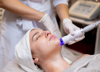 Close-up image of a person receiving melasma treatment.